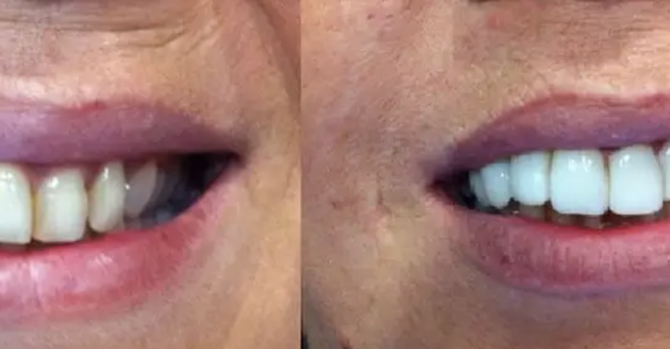 https://clinicadentalbyj.es/wp-content/uploads/2026/05/c3.png