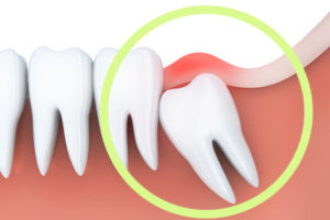 https://clinicadentalbyj.es/wp-content/uploads/2026/05/extracciones-dentales.jpg