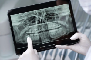 radiografias