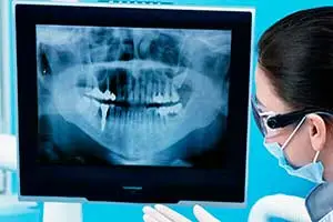 https://clinicadentalbyj.es/wp-content/uploads/2026/06/cirugia-dental-las-gabias-y-la-herradura.webp