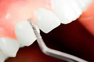 https://clinicadentalbyj.es/wp-content/uploads/2026/06/periodoncia-las-gabias-y-la-herradura.webp